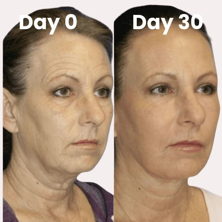 Reversederm⁺ Time Reverse Cream (All-In-One)
