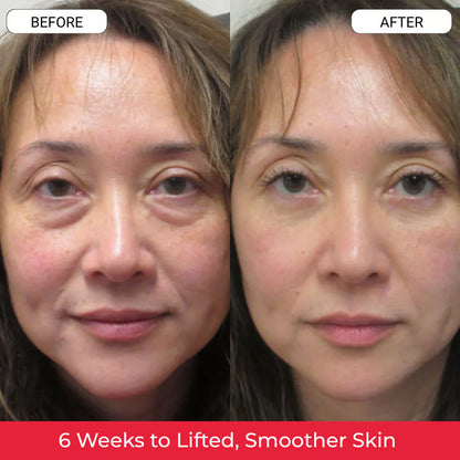 Reversederm⁺ Time Reverse Cream (All-In-One)