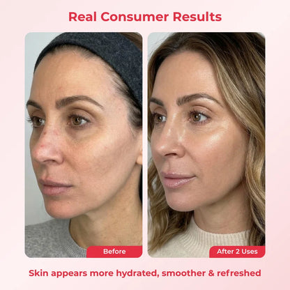 PDRN Deep Mask (4 Masks).