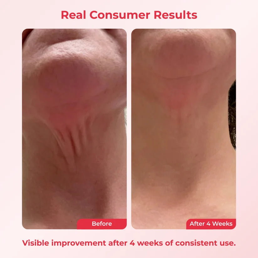 Koriderm⁺ Time Reverse Neck Cream