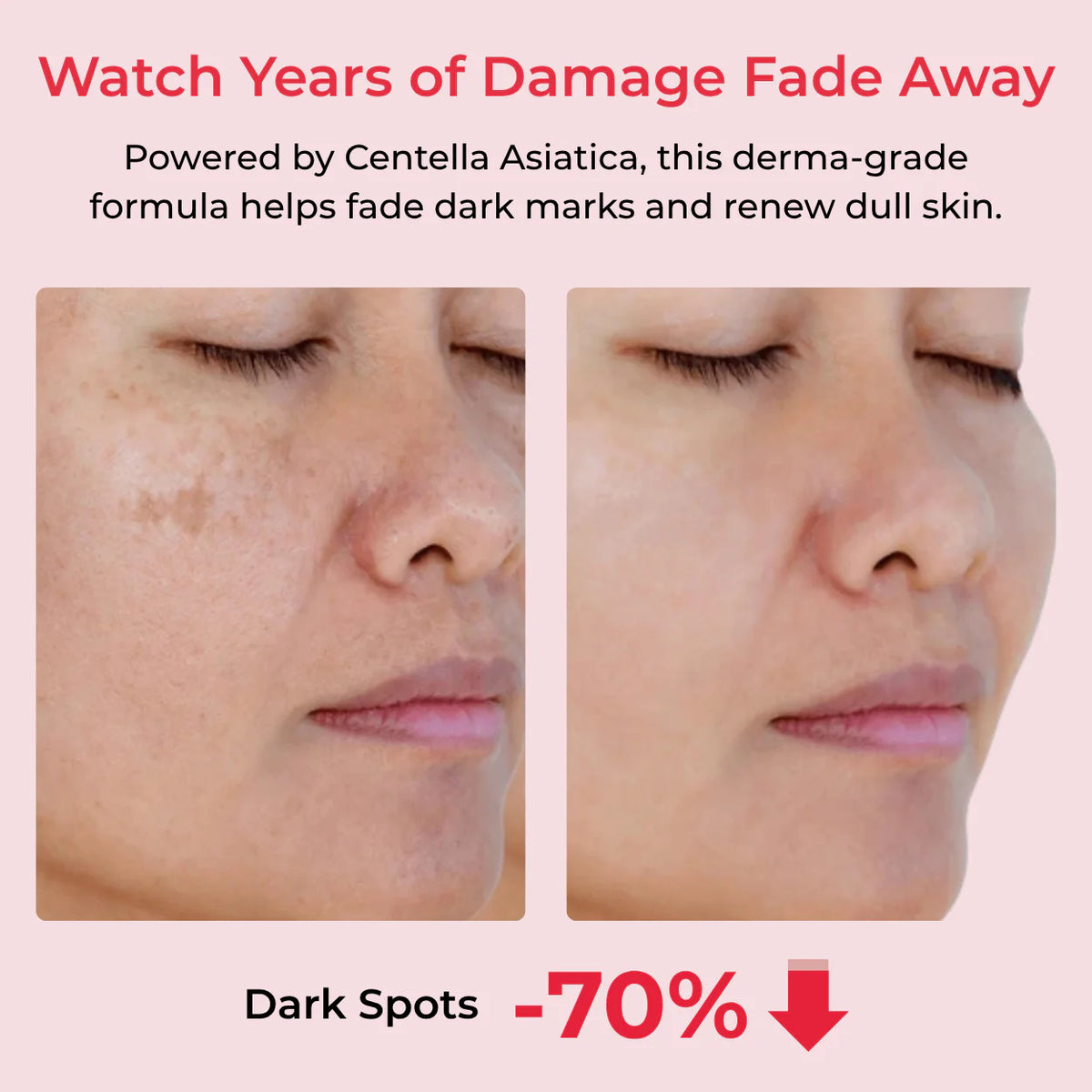 Koriderm⁺ Time Reverse Cream (All-In-One)